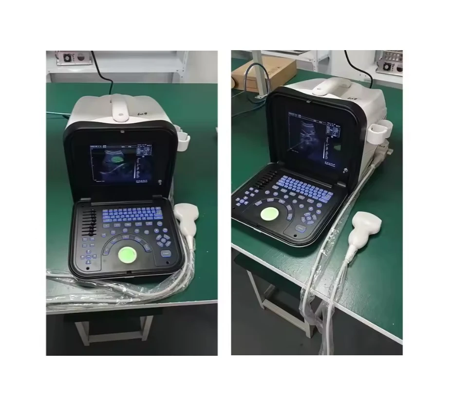 Black and white Portable ultrasounds