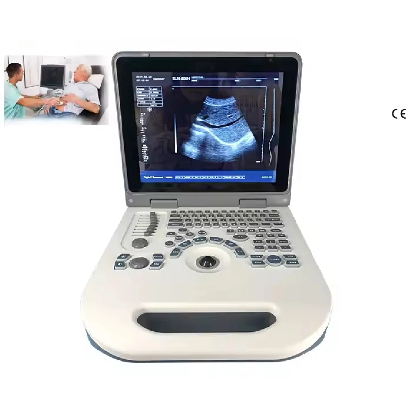 Portable ultrasound