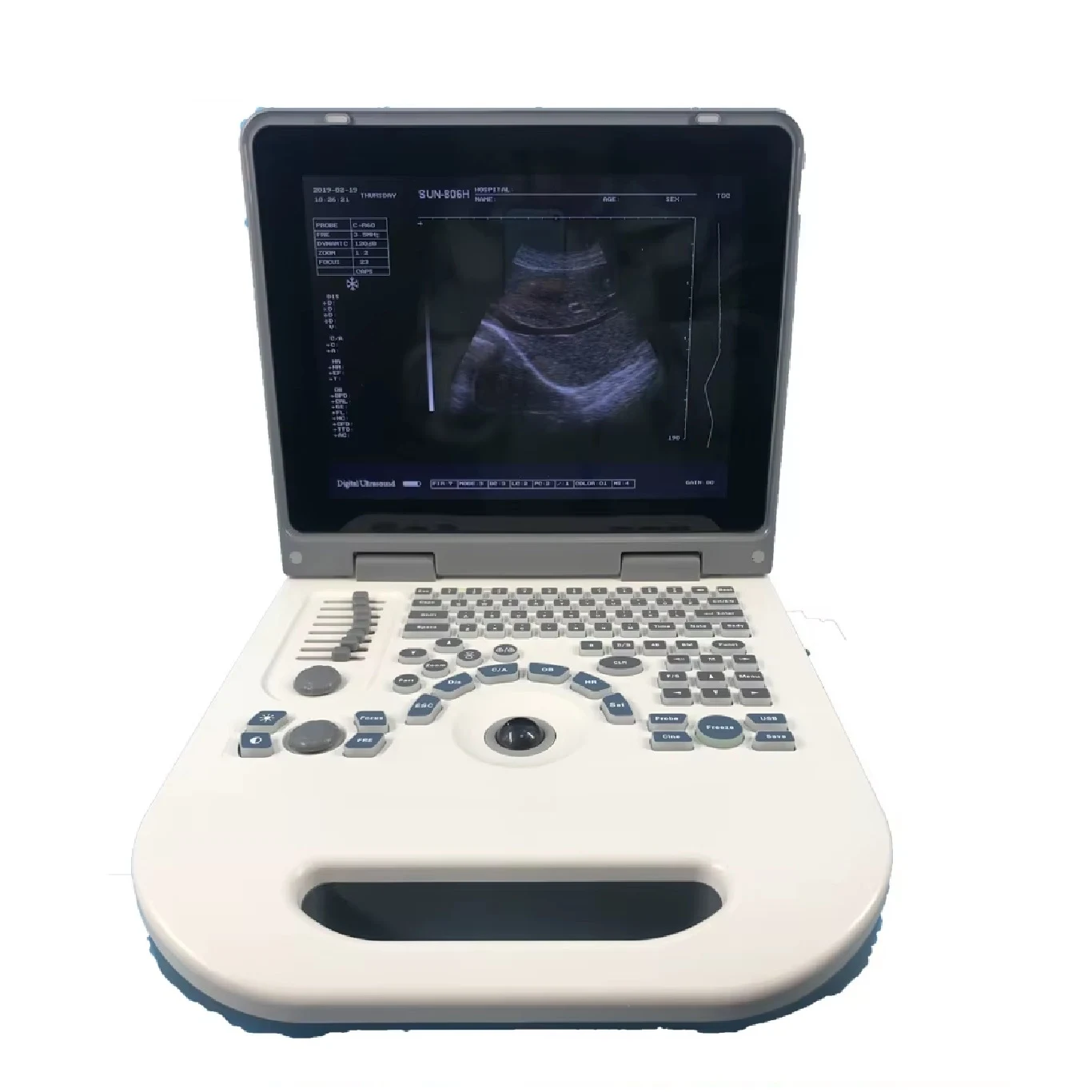 Portable ultrasound