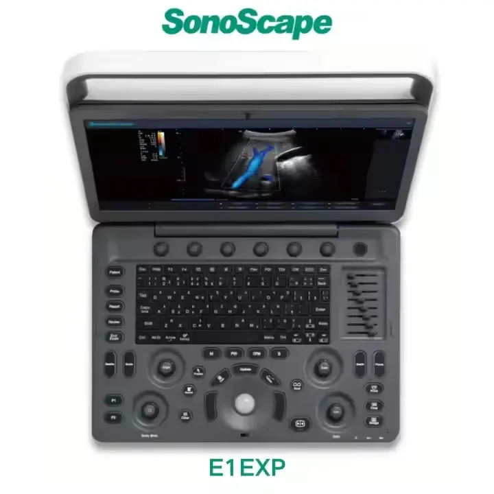 SonoScape ultrasound mofel:E1EXP