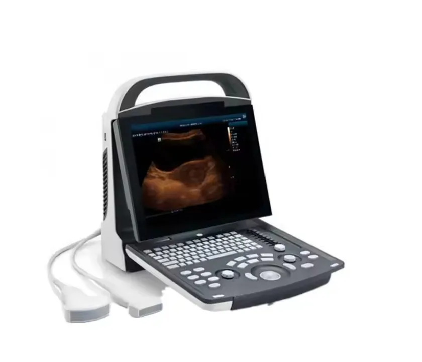 Mindray ultrasound DP-10