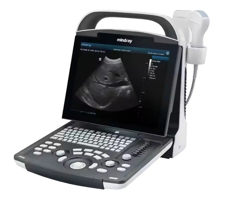 Mindray ultrasound