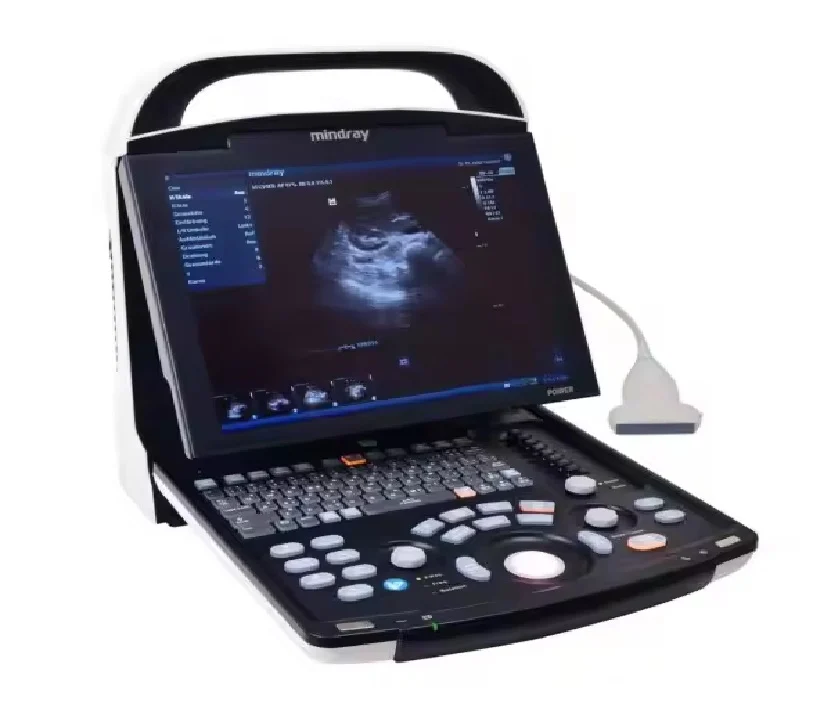 Mindray ultrasound