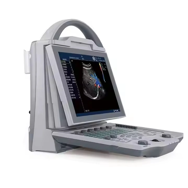 Color Ultrasounds