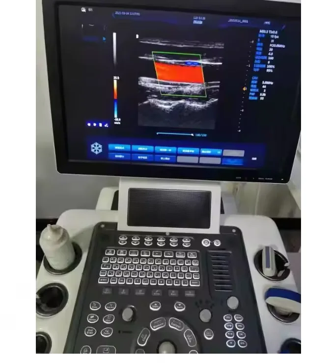 Color Trolly Ultrasound